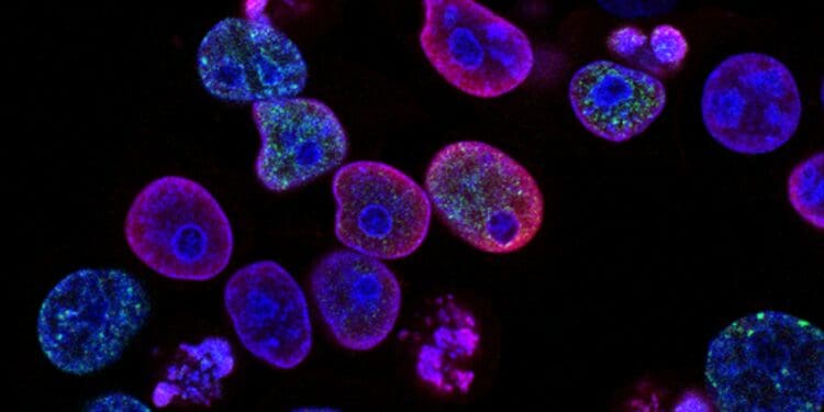Human colorectal cancer cells treated with a topoisomerase inhibitor and an inhibitor of the protein kinase ATR (ataxia telangiectasia and Rad3 related), a drug combination under study as a cancer therapy. Cell nuclei are stained blue; the chromosomal protein histone gamma-H2AX marks DNA damage in red and foci of DNA replication in green.  Created by Yves Pommier, Rozenn Josse, 2014